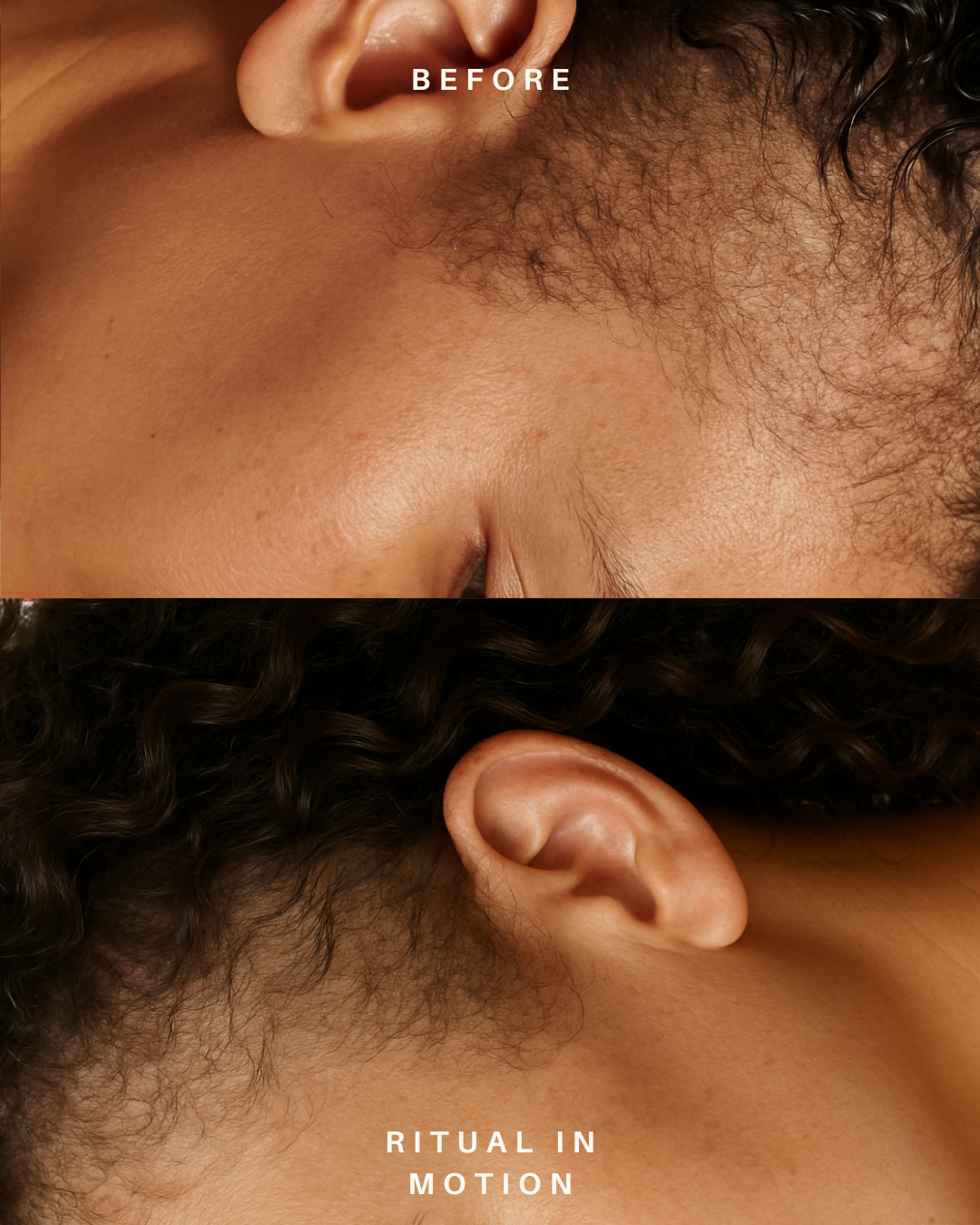 Before and after comparison of hair removal on a person's neck and ear area.